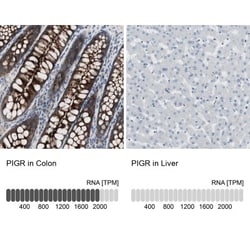 Latrophilin 1/LPHN1 Antibody, Novus Biologicals:Antibodies:Primary Antibodies